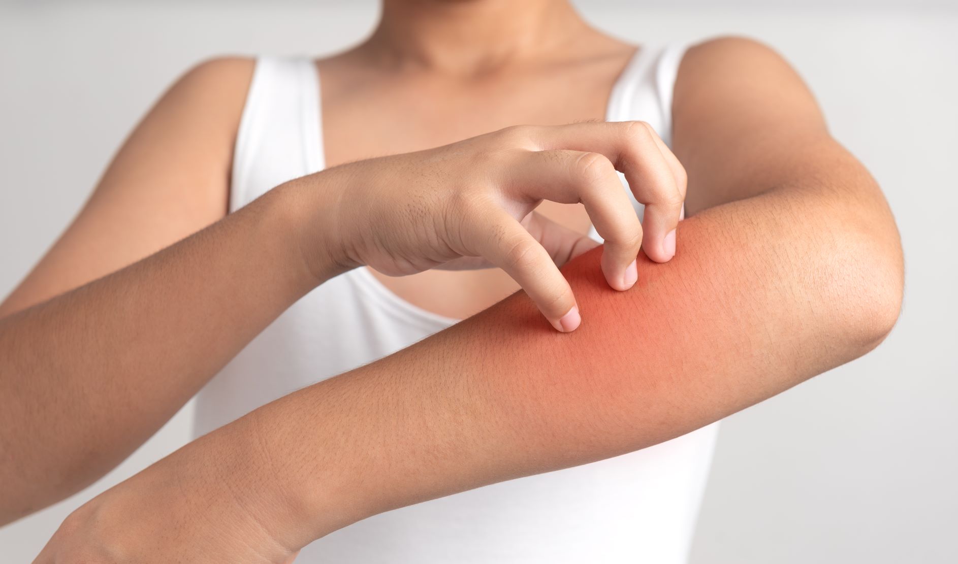 بررسی علل و درمان خشکی پوست